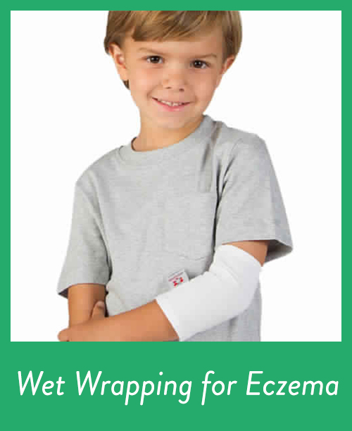 7-tips-for-quick-eczema-and-skin-relief-the-Paleo-mom-wet-wrapping