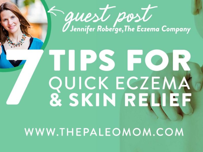 7 Tips for Quick Eczema and Itchy Skin Relief - Guest Post by Jennifer Roberge