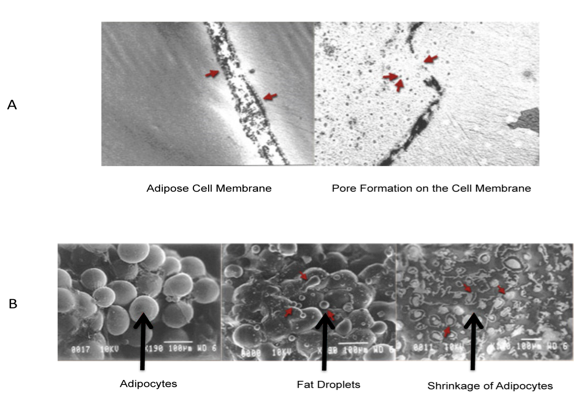 Red light therapy causes pores to form in adipocytes (fat cells) which then release fat