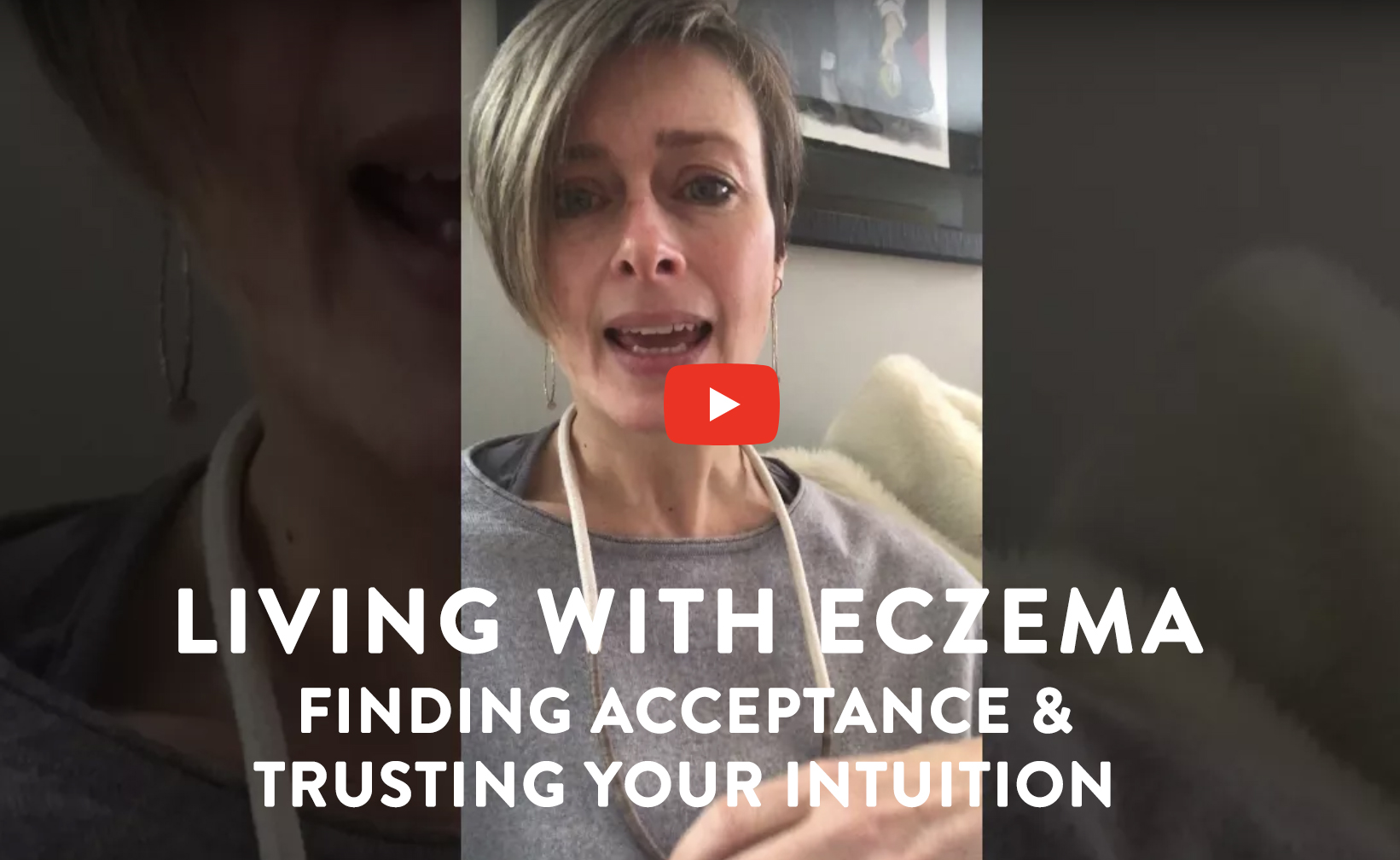 living with Eczema