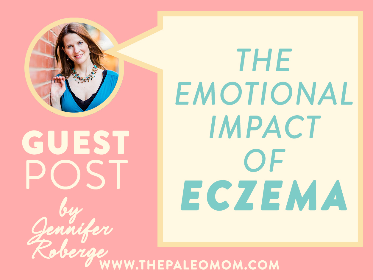 https://www.thepaleomom.com/wp-content/uploads/2018/06/The-Emotional-Impact-of-Eczema.jpg